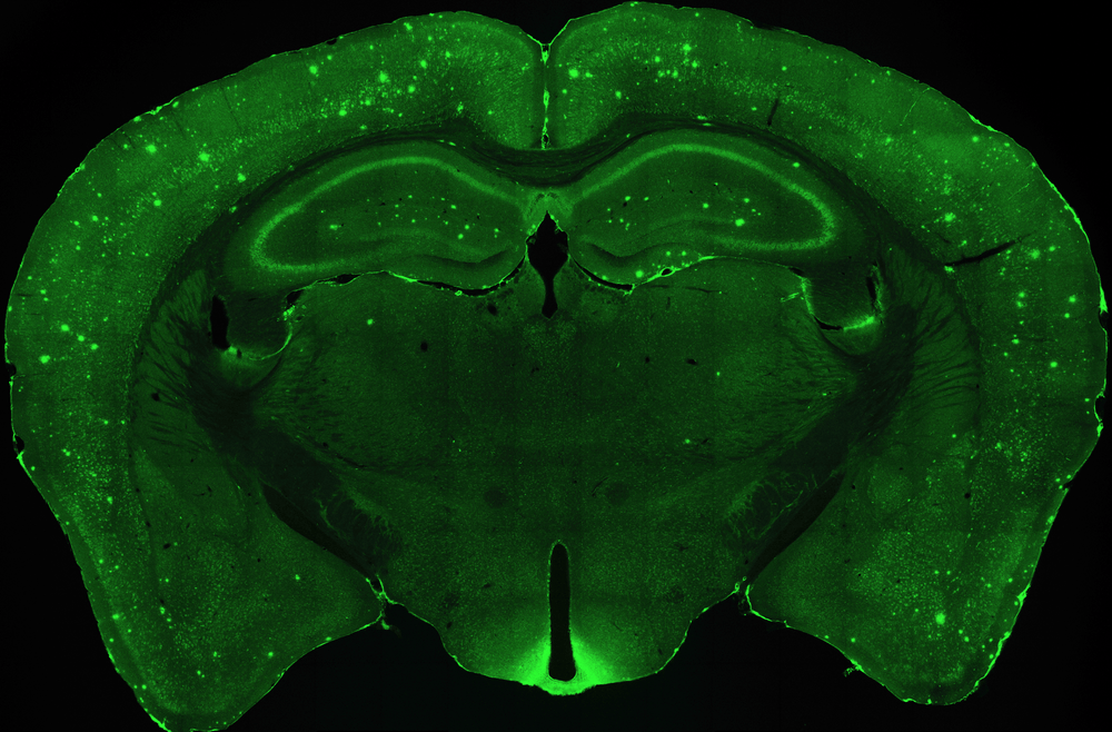 5x_brain-plaques-ad-mouse