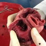 Erteleme Alışkanlığı, Kalp Sorunlarına Neden Olabilir