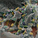 Araştırmacılar Bağırsaktaki Mikrop Kolonilerini Eski Haline Getirdi