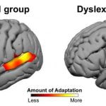 9867322346-dyslexia-3