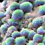 Yağların Kanserin Yayılmasını Hızlandırdığına Dair Artık Daha Fazla Kanıtımız Var