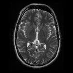 Hamilelik Beyninizin Bağlantılarını Yeniden Oluşturuyor