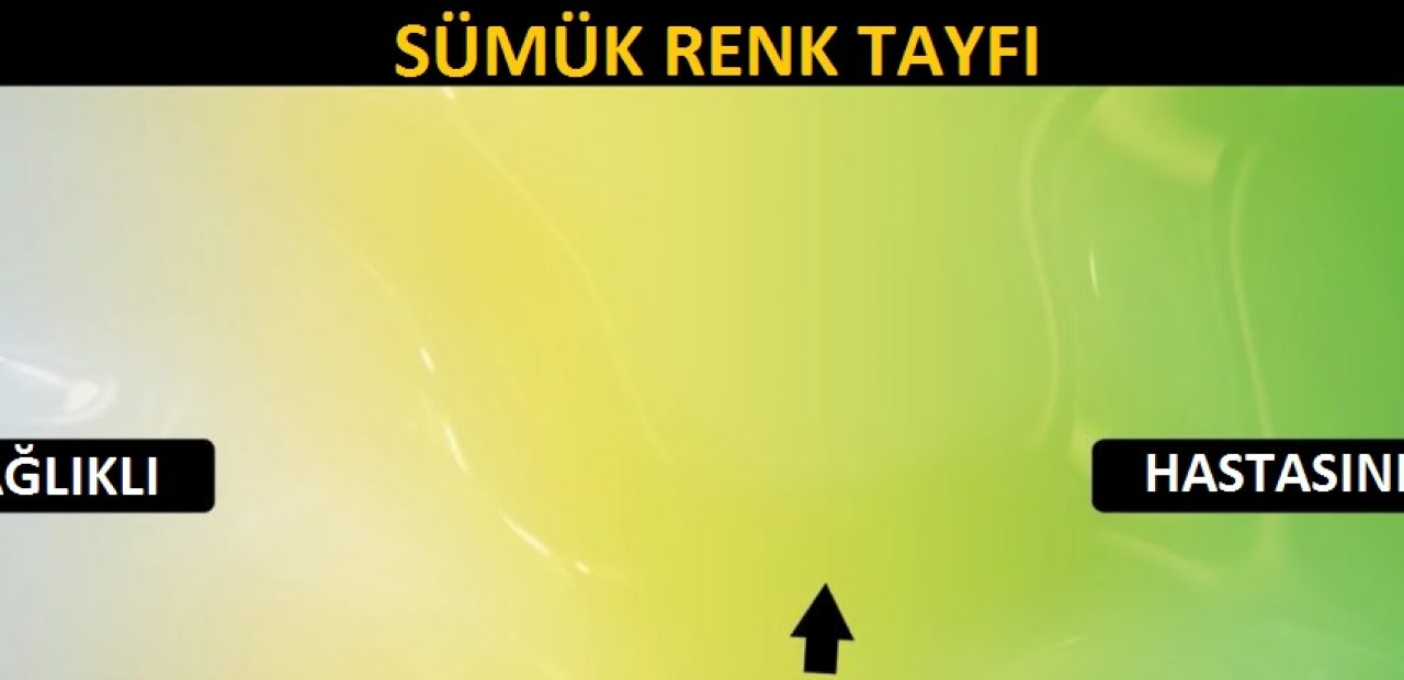 Snot nereden geliyor Görünüm nedeni Snot nereden geliyor Görünüm nedeni