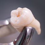 Araştırmacılar, Çiğnemenin Dişlerimize Olan Detaylı Etkilerini Ortaya Çıkardı
