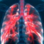 Bilim İnsanları, Daha Önce Bilinmeyen Yeni Bir Akciğer Hücresi Türü Keşfettiler