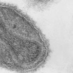 Bilim İnsanları, Sentetik Çiçek Virüsü Dolayısıyla Ciddi Anlamda Endişelenmeye Başladılar