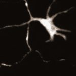 Deri Hücrelerinde Keşfedilen, Nöron Benzeri İlginç Sinyaller