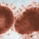 İnsanlar, COVID-19 Virüsünü Yıllardır Taşıyor Olabilir