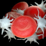 COVID-19, Kan Pıhtılaştıran Hücrelerde ‘Hiperaktiviteye’ Sebep Oluyor