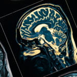 Beyin Sağlığının Yeni Ölçütü