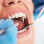 Asidin Dişlere Nasıl Zarar Verdiğini Anlamaya Yardımcı Olan Yeni Yöntem
