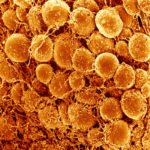 Kahverengi Yağ Benzeri Hücre Nakli, Diyabet ve Obezlikte Umut Vadediyor