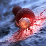 Ağır COVID-19 Hastalarındaki Alışılmadık T Hücreleri, Hastalığın Sonucunu Haber Verebilir