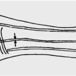 Human-Forearm-Median-Artery[1]