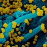Ürkütücü Vaka Çalışmasına Göre, Belirti Göstermeyen COVID-19 Taşıyıcısı 70 Gün Boyunca Virüs Yaymış