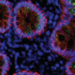 Bağışıklık Sistemi, COVID-19’dan Kurtulduktan Sonra Uzun Bir Savunma Yapıyor