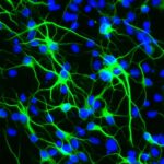 Uzun Yaşam Geni, Beyindeki Kök Hücreleri Stresten Koruyor
