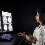 COVID-19’da MRI ve CT Taramaları Bağlantı Sergiliyor