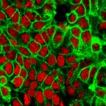 Kansere Yol Açan Mutasyon, 40 Yıl Önce Ortaya Çıkabilir