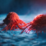 Kanser Hücreleri, Bağışıklık Sisteminden Kaçarken Beklenmedik Hileler Kullanıyor