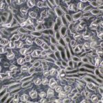 Bitkilerin Su Kaybını Kontrol Etme Kabiliyeti, Zannedilenden Önce Evrimleşmiş