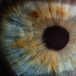 Gözlerde Alzheimer Tehlikesinin İpuçları