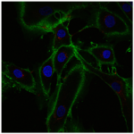 Yaşlı Cilt Hücreleri Yeniden Programlanarak 30 Yıl Gençleştirildi